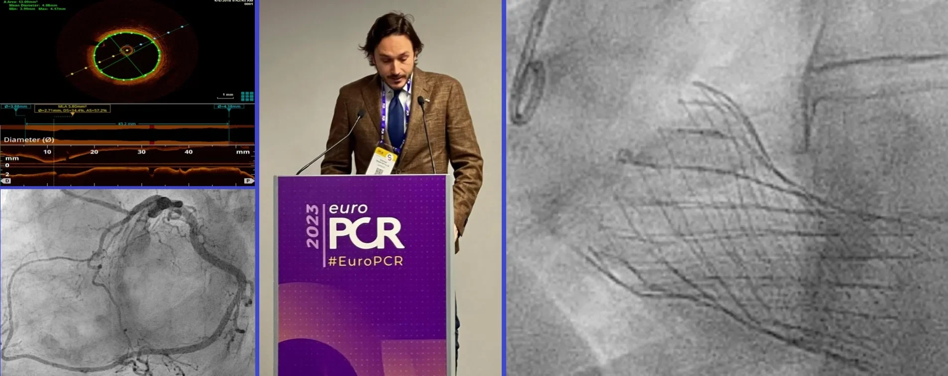 Επεμβατικός Καρδιολόγος Ανδρέας Τριανταφύλλης - Interventional Cardiologist Andreas Triantafyllis