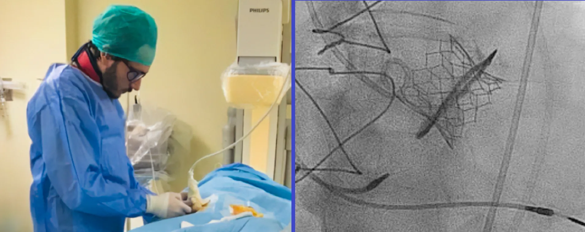 Επεμβατικός Καρδιολόγος Ανδρέας Τριανταφύλλης - Interventional Cardiologist Andreas Triantafyllis